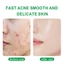 BSKM Serum hỗ trợ giảm mụn dưỡng ẩm làm mịn da xóa mờ vết thâm hiệu quả chuyên dụng 28g 0185