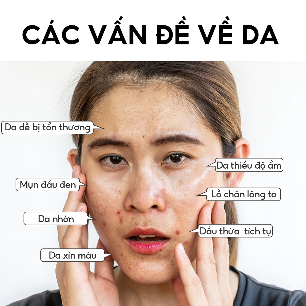 Ảnh Mặt nạ bùn gel VIBRANT GLAMOUR 5g nhiều loại hỗ trợ giảm mụn chống lão hóa se khít lỗ chân lông 2