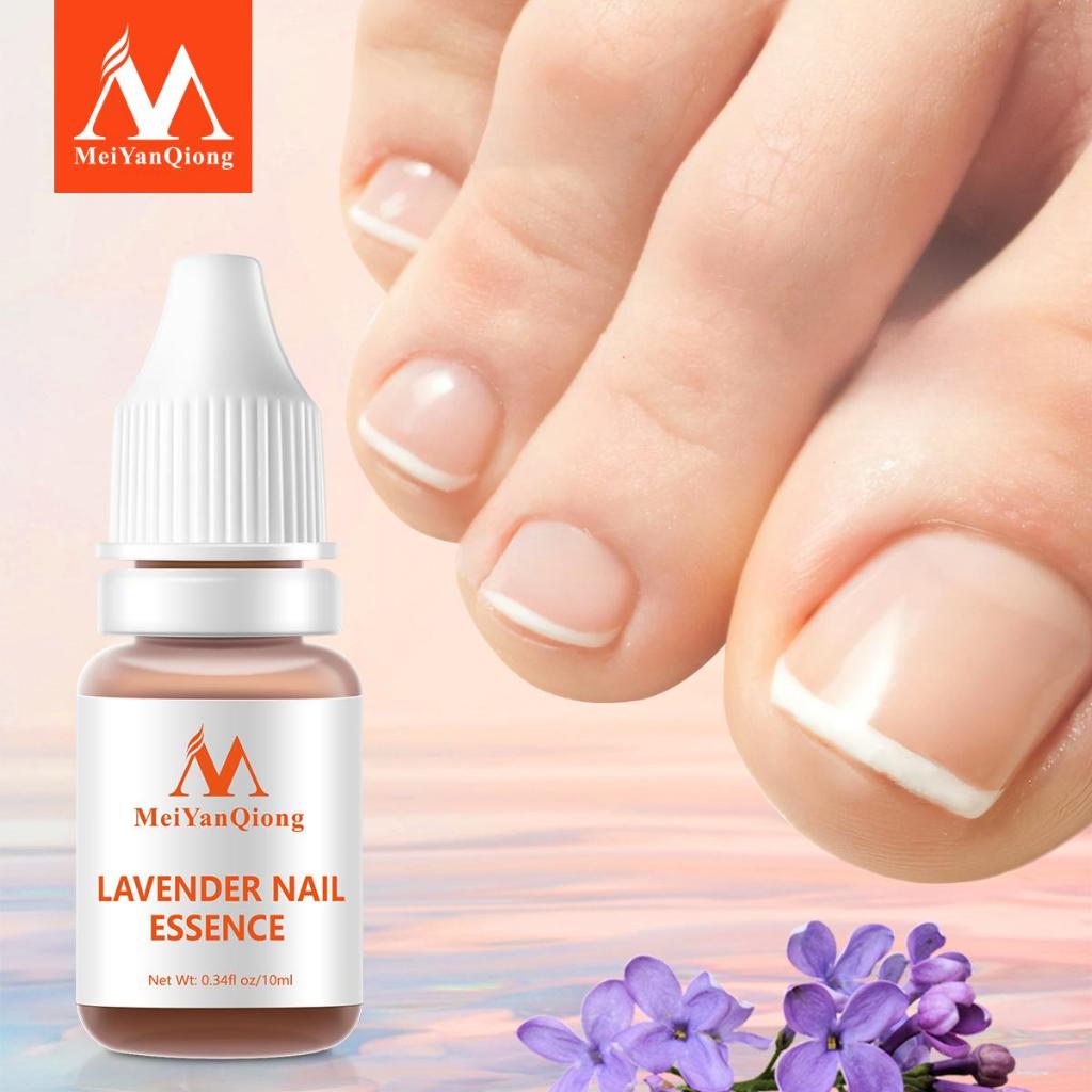 Ảnh MeiYanQiong Tinh Chất Hoa Oải Hương Hỗ Trợ Giảm Bệnh Nấm Móng 10Ml 4