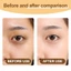 Kem dưỡng mắt BSKM Retinol xóa nếp nhăn quanh mắt 20g 0277