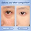 BSKM Kem Mắt Vitamin C Xóa Quầng Thâm Và Túi Dưới Mắt Để Sưng Mắt Làm Sáng Đôi Mắt Eye Cream 20ml 0260