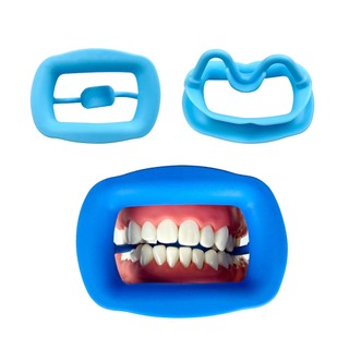 1 Cái Dụng Cụ Mở Miệng Nha Khoa Silicon Mềm Chỉnh Nha Cheek Retractor Răng Nội Miệng Môi Mở Rộng Nha Sĩ Chăm Sóc Răng Miệng Dụng Cụ