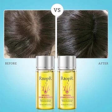 RtopR Tinh dầu dưỡng tóc ngăn rụng tóc Dầu mọc tóc chống rụng tóc thảo dược, serum kích mọc tóc nhanh, tăng mật độ tóc phục hồi tóc yếu, phù hợp rụng tóc sau sinh