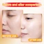 BSKM Serum Retinol Niacinamide Hyaluronic Acid Chống Lão Hóa Dưỡng Trắng Xóa Nếp Nhăn Làm Săn Chắc Da Mặt 28ml 0253