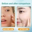 BSKM Serum Hyaluronic Acid dưỡng ẩm làm trắng chống lão hóa giảm nếp nhăn phục hồi chăm sóc da 28ml 0284