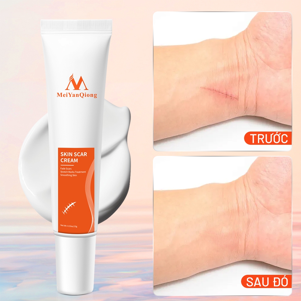 Ảnh MeiYanQiong Kem sẹo Giảm Sẹo lồi/lõm/sẹo thâm do mụn/phục hồi các tổn thương trên da/thúc đẩy tái tạo da 15ml 3