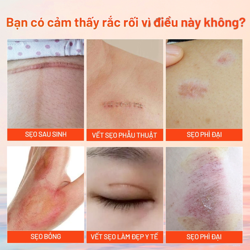 Ảnh MeiYanQiong Kem sẹo Giảm Sẹo lồi/lõm/sẹo thâm do mụn/phục hồi các tổn thương trên da/thúc đẩy tái tạo da 15ml 2