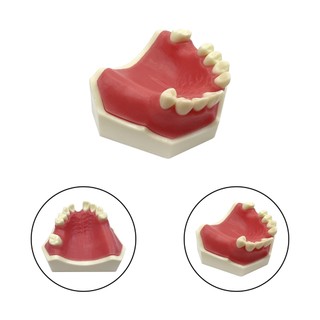 Mô hình cấy ghép răng hàm trên/hàm dưới cơ bản, kẹo cao su mềm, phù hợp thực hành học sinh