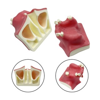 Mô hình cấy ghép răng hàm trên/hàm dưới cơ bản, kẹo cao su mềm, phù hợp thực hành học sinh