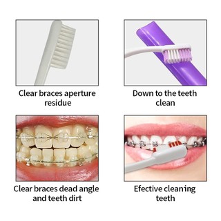 8 Cái / bộ Du Lịch Chỉnh Nha Chăm Sóc Răng Miệng Bộ Bàn Chải Đánh Răng Có Thể Gập Lại Bàn Chải Răng Miệng Nha Khoa Gương Flos Ortho Wax Bộ Làm Sạch Răng