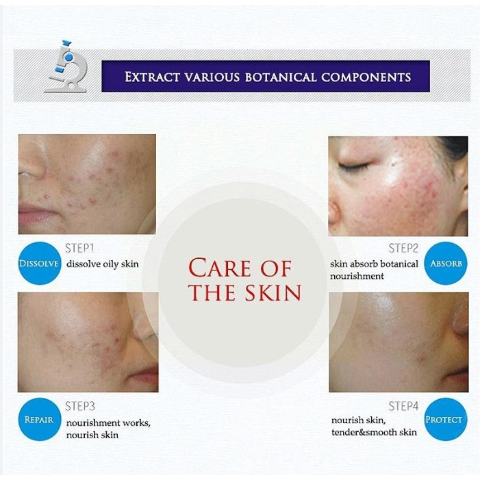 Kem Hỗ Trợ Giảm Mụn Đầu Đen Kiềm Dầu Se Khít Lỗ Chân Lông Làm Trắng Da Bioaqua