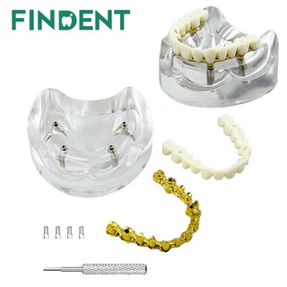 1 Chiếc Nha Khoa 4 Cấy Mô Hình Quá Răng Phục Hồi Maxillary Có Thể Tháo Rời Typodont Răng Mô Hình Giảng Dạy Nha Khoa Mô Hình Nghiên Cứu Mới