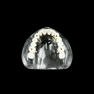 1 Chiếc Nha Khoa 4 Cấy Mô Hình Quá Răng Phục Hồi Maxillary Có Thể Tháo Rời Typodont Răng Mô Hình Giảng Dạy Nha Khoa Mô Hình Nghiên Cứu Mới
