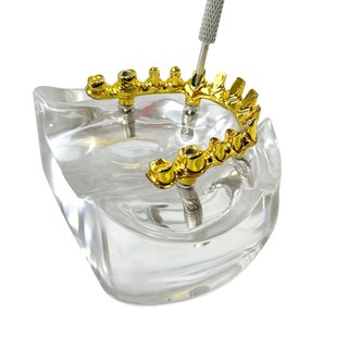 1 Chiếc Nha Khoa 4 Cấy Mô Hình Quá Răng Phục Hồi Maxillary Có Thể Tháo Rời Typodont Răng Mô Hình Giảng Dạy Nha Khoa Mô Hình Nghiên Cứu Mới