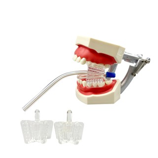5 Chiếc Nha Khoa Silicon Miệng Hỗ Trợ Giữ Nước Bọt Ejector Hút Đầu Tắc Miếng Lót Miệng Dụng Cụ Thu Hút Vệ Sinh Răng Miệng Chất Liệu