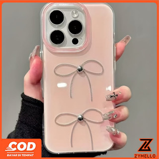Ốp Lưng Cho OPPO Reno 14F Reno13 F Reno13 Pro Reno12 F Reno11 Pro Reno11 F Reno10Pro Reno8T Reno8Z Reno7Z Reno6Z Reno8 Reno5 Reno4 Vỏ Điện Thoại Di Động TPU Chống Sốc IMD
