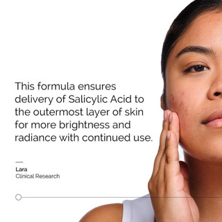 Huyết thanh axit salicylic thông thường