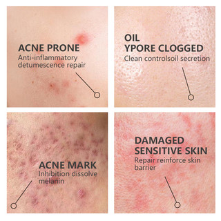The Ordinary niacinamide 10% pore tightening serum oil control skin recovery serum facial care