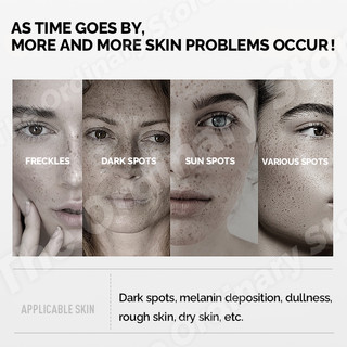 The Ordinary Alpha Arbutin Serum For Face Dark Spot Remover Brightening Moisturizer Skin Care