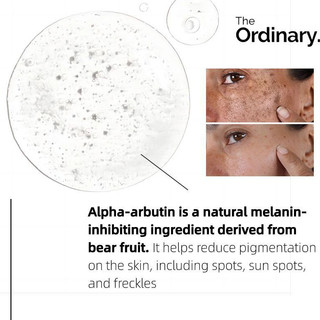 The Ordinary Alpha Arbutin Serum For Face Dark Spot Remover Brightening Moisturizer Skin Care