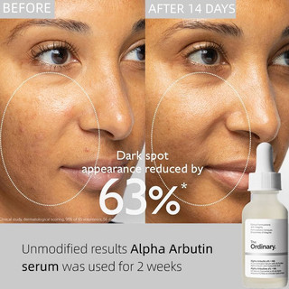 The Ordinary Alpha Arbutin Serum For Face Dark Spot Remover Brightening Moisturizer Skin Care