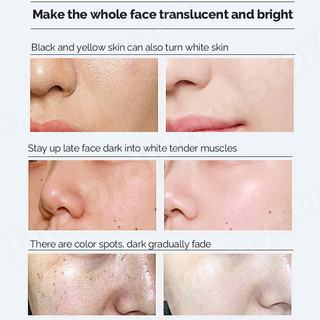The Ordinary Alpha Arbutin Serum For Face Dark Spot Remover Brightening Moisturizer Skin Care