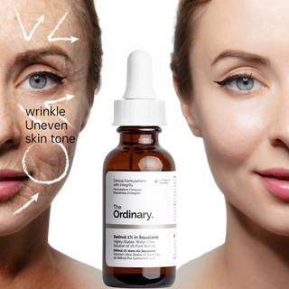 The Ordinary Retinol Serum For Face Anti Aging Wrinkles Remover Moisturizer Skin Care