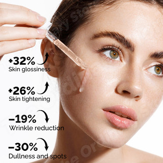 The Ordinary Lactic Acid Peeling Serum For Face Dark Spot Remover Brightening Moisturizer Pimple Remover Acne Scars Skin Care