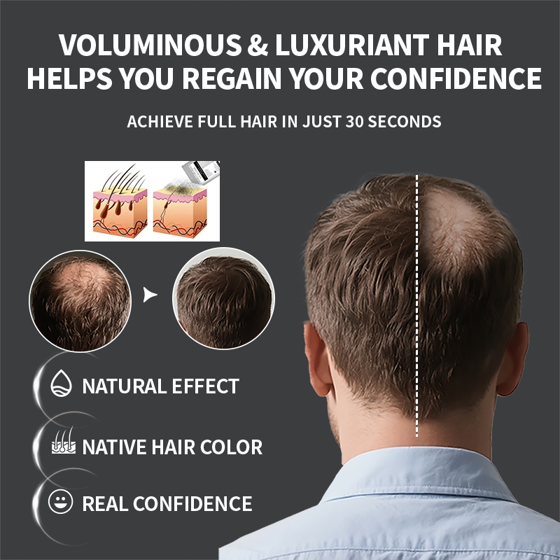 Bột phủ dày tóc hói tóc thưa LEWEDO Hair Trang phục bổ sung 100g