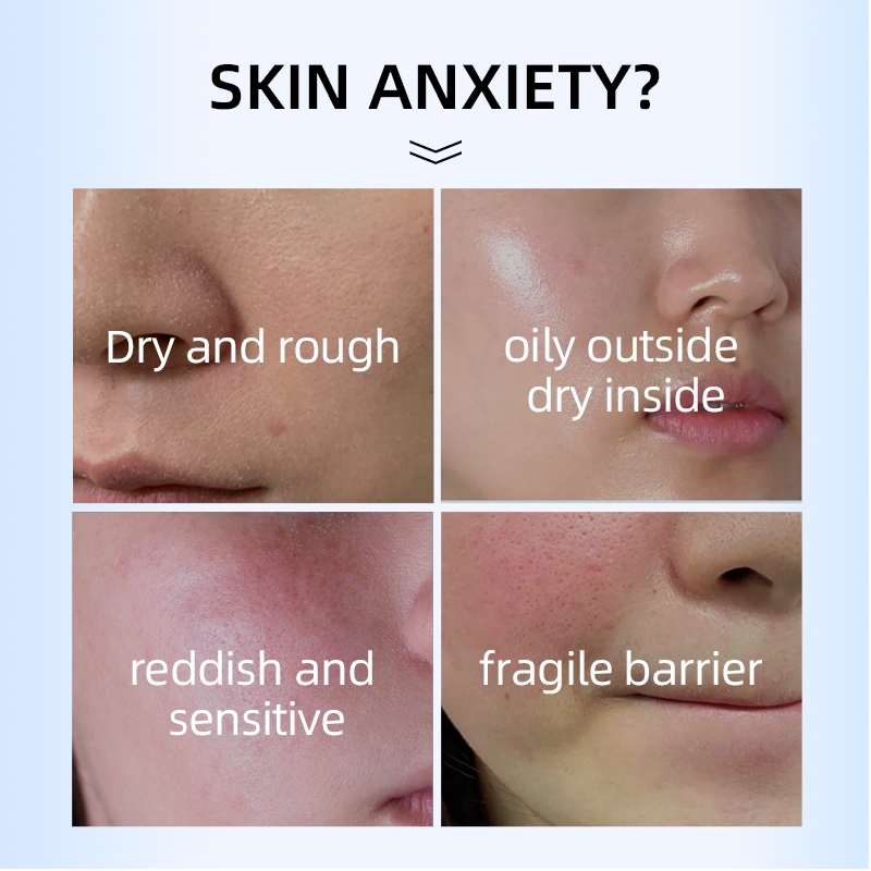 Kem Dưỡng Ẩm Axit Hyaluronic/Dưỡng Ẩm Thâm Nhập Da/Dưỡng ẩm cho da khô/Làm trắng và dưỡng ẩm da 30g