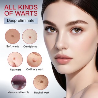 SADOER Mụn cóc Loại bỏ Serum 30ml Skin Tag Remover Warts Dung dịch kháng khuẩn Da mịn Mặt cơ thể Mục đích chung