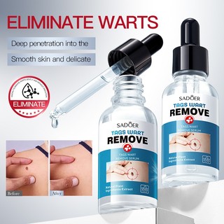 SADOER Mụn cóc Loại bỏ Serum 30ml Skin Tag Remover Warts Dung dịch kháng khuẩn Da mịn Mặt cơ thể Mục đích chung