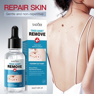 SADOER Mụn cóc Loại bỏ Serum 30ml Skin Tag Remover Warts Dung dịch kháng khuẩn Da mịn Mặt cơ thể Mục đích chung