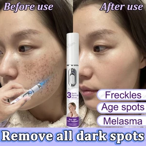 Loại bỏ 99,99% sắc tố tẩy vết thâm Loại bỏ tàn nhang bút laser loại bỏ tàn nhang sắc tố nám chăm sóc loại bỏ sắc tố đốm đen loại bỏ kem