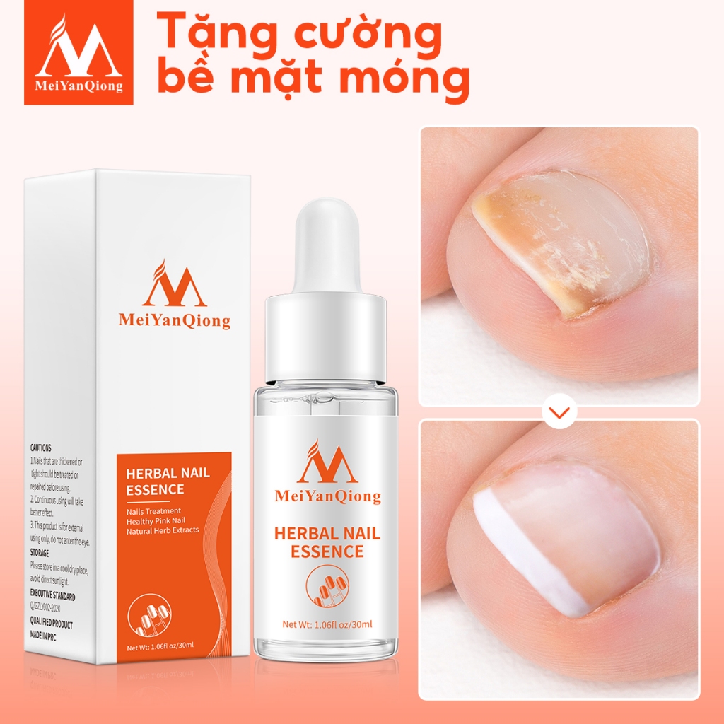 MeiYanQiong Tinh Chất Trị Nấm Móng Tay / Chân Loại Bỏ Nấm Móng 30ml