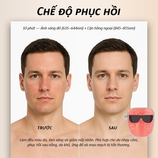Mặt Nạ Ánh Sáng Sinh Học NIPLIFE EM-01 Công Nghệ Ánh Sáng Sinh Học Giúp Trẻ Hóa Làn Da Hiệu Quả