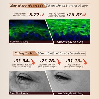 Mặt Nạ Ánh Sáng Sinh Học NIPLIFE EM-01 Công Nghệ Ánh Sáng Sinh Học Giúp Trẻ Hóa Làn Da Hiệu Quả
