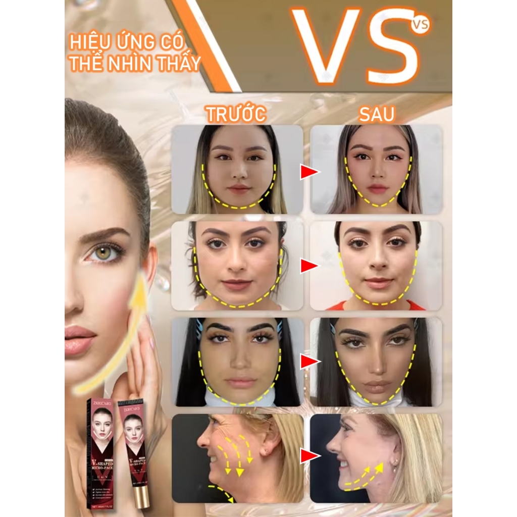 7 ngày Loại bỏ mỡ mặt, Giảm mỡ mặt nữ tính, Giảm cằm đôi, Kem nâng cơ mặt, V-Line Chin, Giảm mỡ mặt, Kem nâng cơ mặt