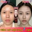 Kem nâng cơ, giảm mỡ mặt nữ tính, loại bỏ mỡ mặt 7 ngày, giảm cằm đôi, tạo V-line