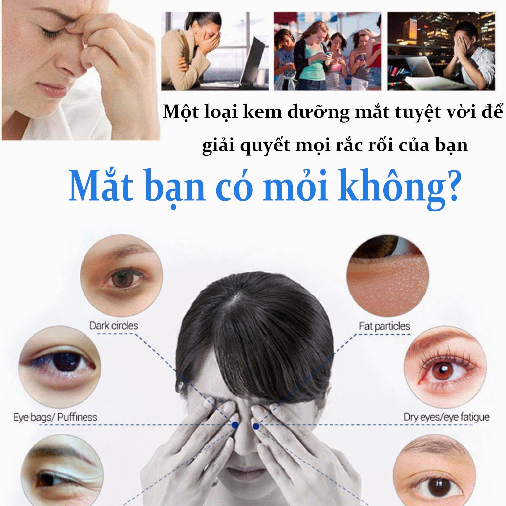 Kem dưỡng mắt loại bỏ quầng thâm 7 ngày, chăm sóc vùng mắt, giảm thâm quầng
