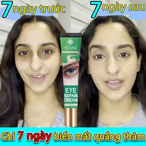 Tạm biệt quầng thâm 7 ngày sau Giảm quầng thâm Kem dưỡng mắt Kem dưỡng mắt Tinh chất mắt Loại bỏ quầng thâm