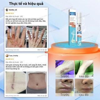 Bút laser xóa nhanh - sẹo lồi, sẹo phẫu thuật, sẹo bỏng, sẹo trẻ em