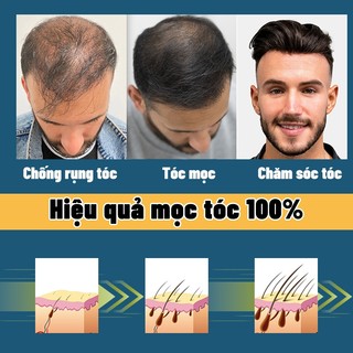 Tinh chất hỗ trợ tăng trưởng tóc, giảm hói đầu, rụng tóc areata, rụng tóc Địa Trung Hải, rụng tóc bẩm sinh