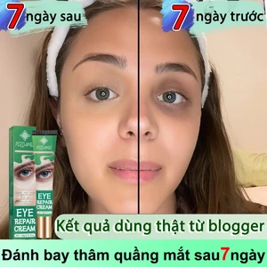 Kem dưỡng mắt giảm quầng thâm, phục hồi vùng da quanh mắt, dưỡng ẩm nhẹ nhàng