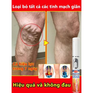 Giảm Tĩnh Mạch Bút Laser Chân Ánh Sáng Sóng Chăm Sóc Giảm Va Đập Di Động Không Thoải Mái Thích Hợp Cho Người Cao Tuổi Trung Niên​