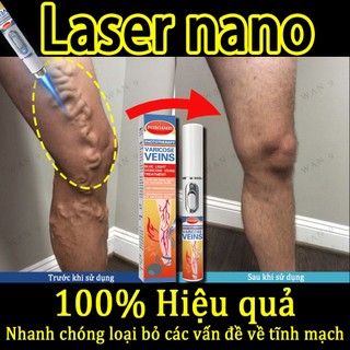 Giảm Tĩnh Mạch Bút Laser Chân Ánh Sáng Sóng Chăm Sóc Giảm Va Đập Di Động Không Thoải Mái Thích Hợp Cho Người Cao Tuổi Trung Niên​