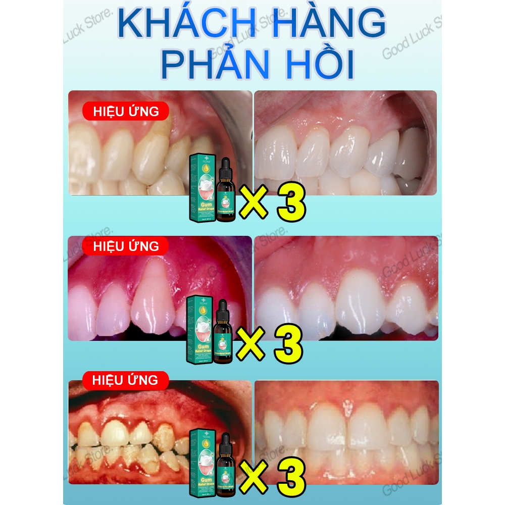 Giải quyết 99,99% các vấn đề về kẹo cao su Dầu đinh hương cho đau răng hôi miệng nướu đau răng giảm đau răng phun