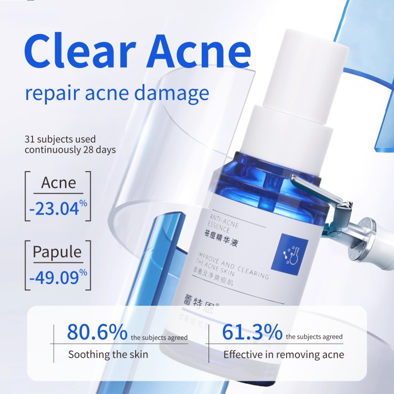 Tinh chất chống mụn chất lỏng/loại bỏ mụn trứng cá và chống dị ứng/Giảm đỏ da/Làm dịu và phục hồi da