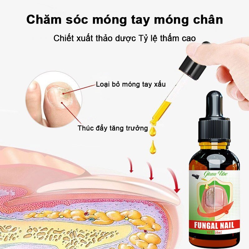 Serum điều trị nấm móng tay/chân, không tái phát, không cần loại bỏ móng