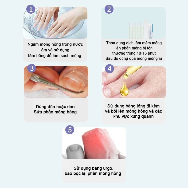 Serum điều trị nấm móng tay/chân, không tái phát, không cần loại bỏ móng
